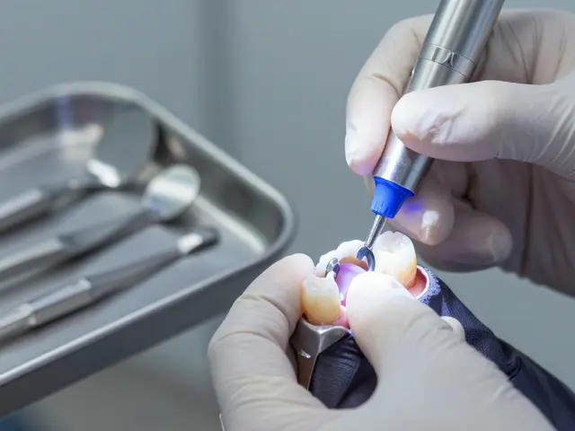 V čem je lepší bílá plomba? Porovnání kompozitních plomb s jinými materiály