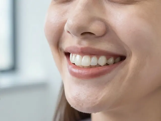 Co potřebujete vědět o nalepovacích zubech: cena, trvanlivost a co vás čeká při instalaci