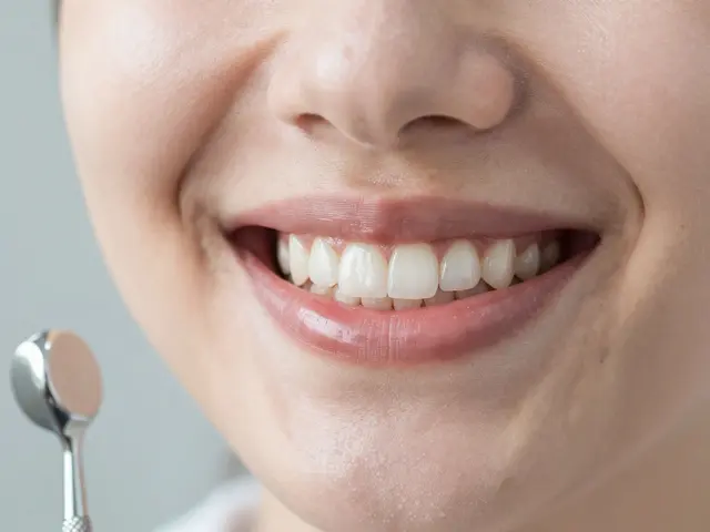 Fazety na křivé zuby: Všechny otázky a odpovědi, které potřebujete znát