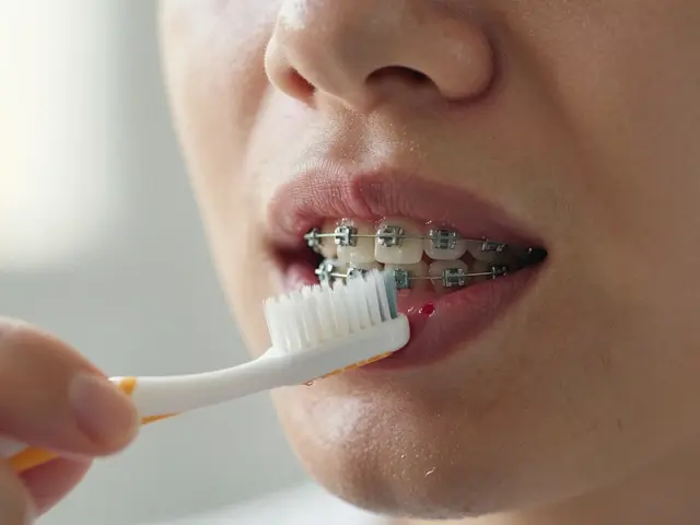 Jak uklidnit bolavé dásně po rovnátkách: praktické rady pro klid a hojení