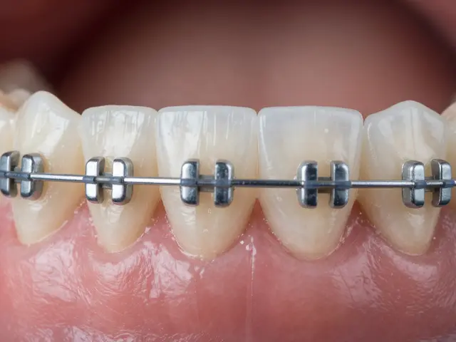 Keramické rovnátka a zubní hygiena: Proč návštěvu hygienistky nevyhnete
